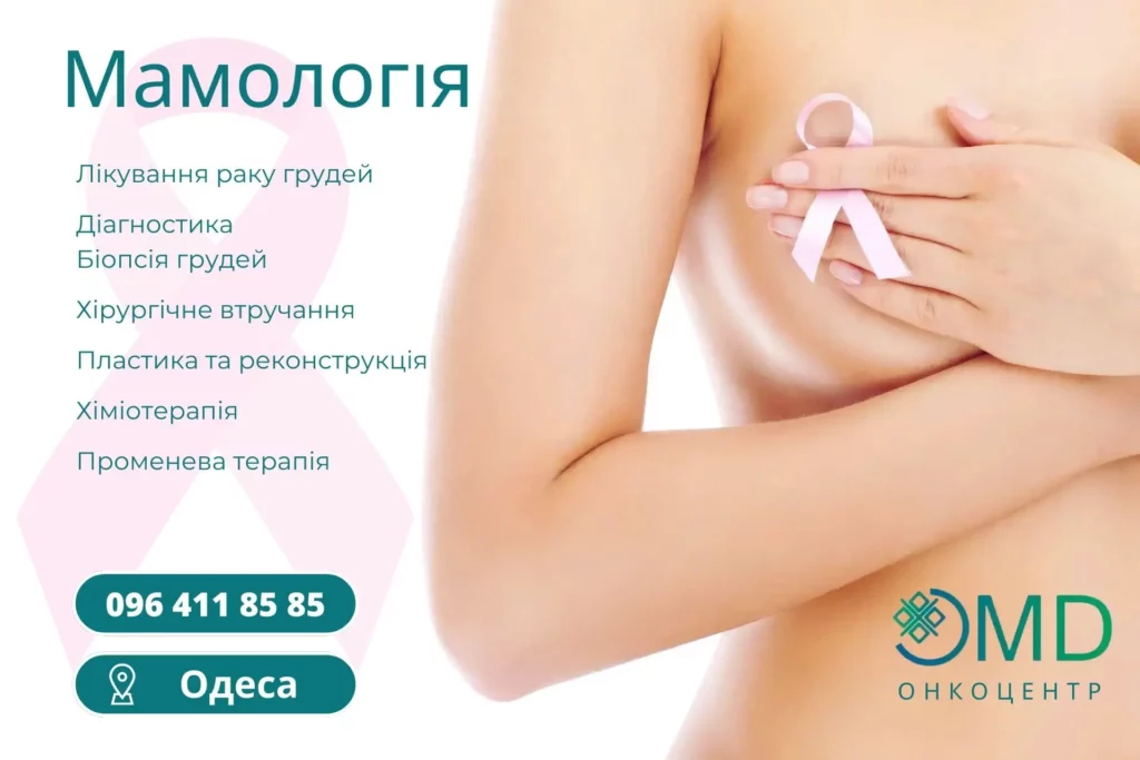 Лечение рака молочной железы в Одессе