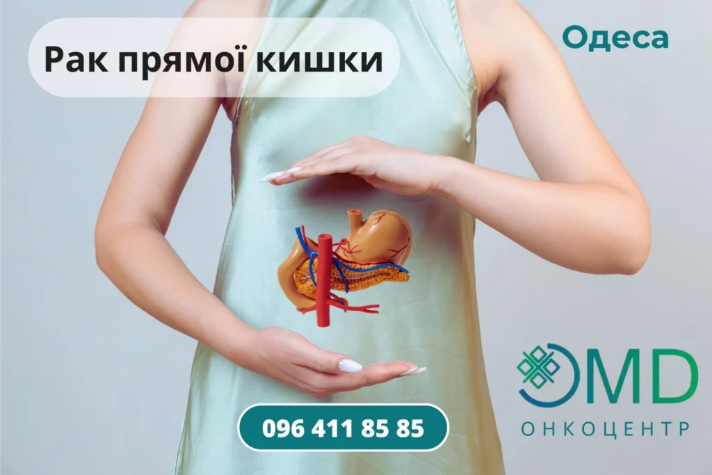 Рак прямой кишки Лечение и диагностика Одесса Онкоцентр лечение ОМД онкоцентр