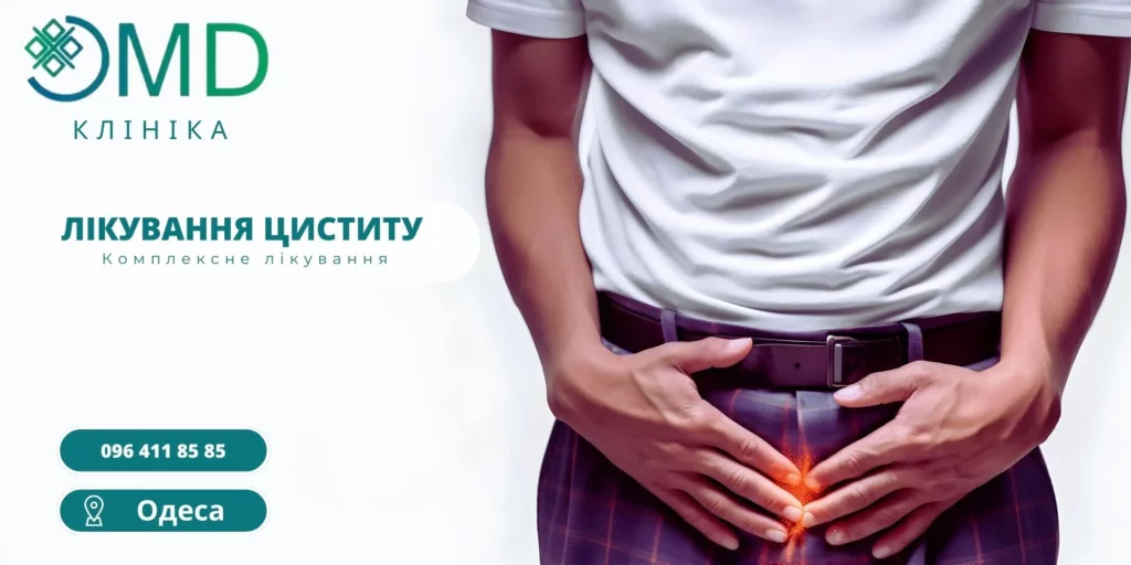Цистит — воспаление мочевого пузыря лечение в Одессе у женщин